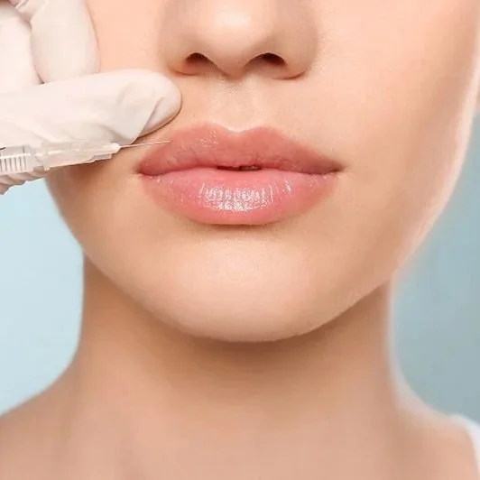 Close-up of a woman receiving lip injections from a healthcare professional.