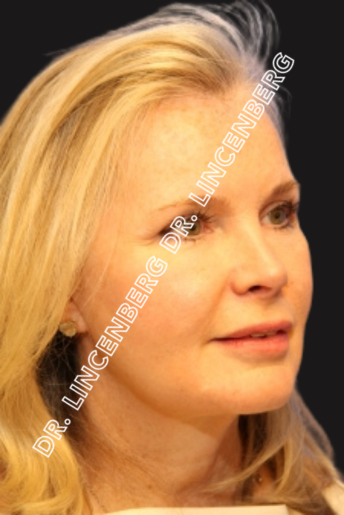 Close-up of a woman with blonde hair, smiling slightly, against a dark background, with a watermark from Dr. Linceberg.