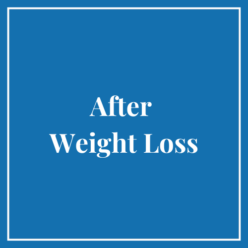 After Weight Loss