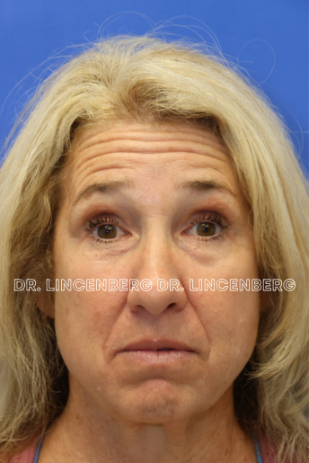 Close-up of a woman with blond hair against a blue background, with text overlay reading "Dr. Lincengberg."