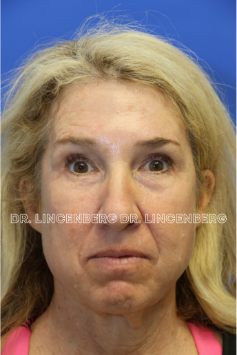 Close-up of a woman's face with blonde hair and a serious expression, against a blue background.