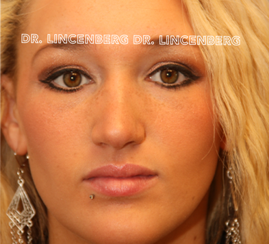 Close-up of a woman with blonde hair, brown eyes, and jewelry, with text reading 'Dr. Lincenberg Dr. Lincenberg' across her face.