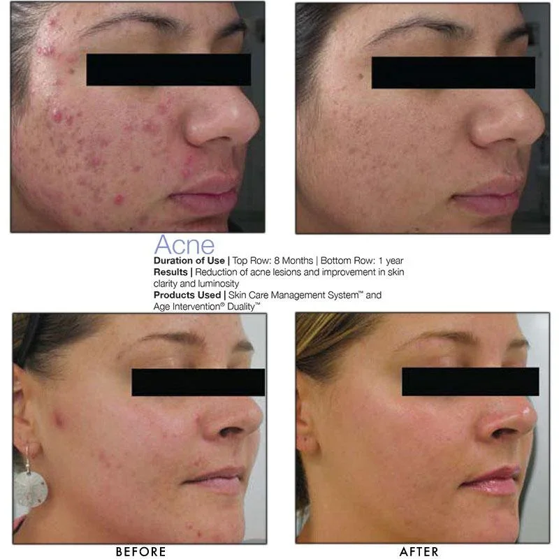 jan-marini-age-intervention-duality-md-313543.webp