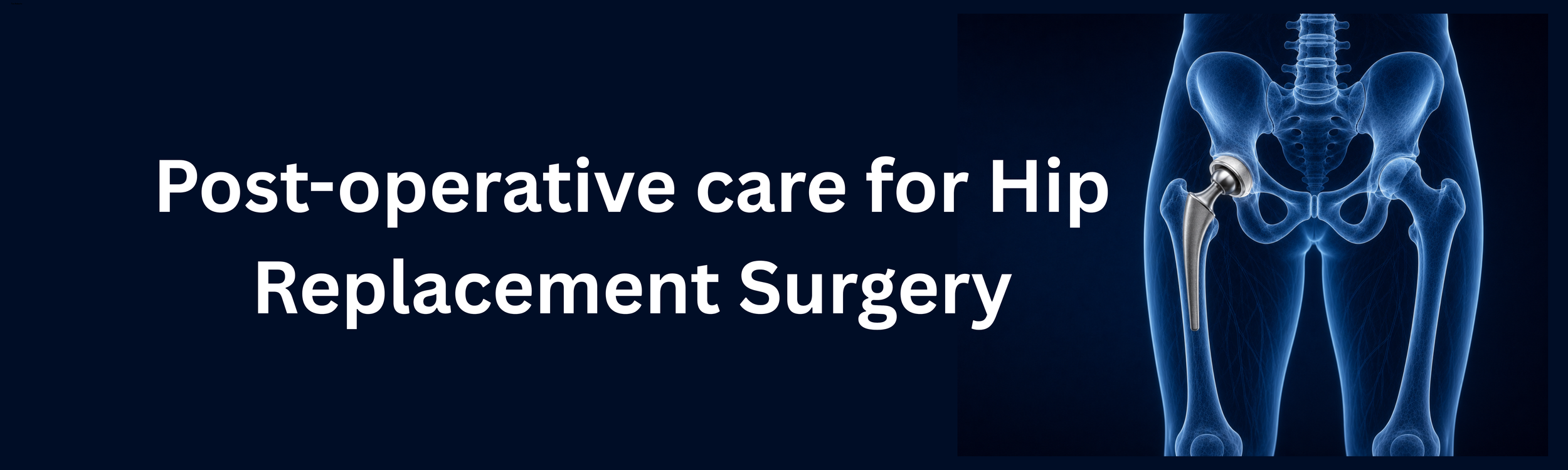 Post op care for Hip Replacement Surgery