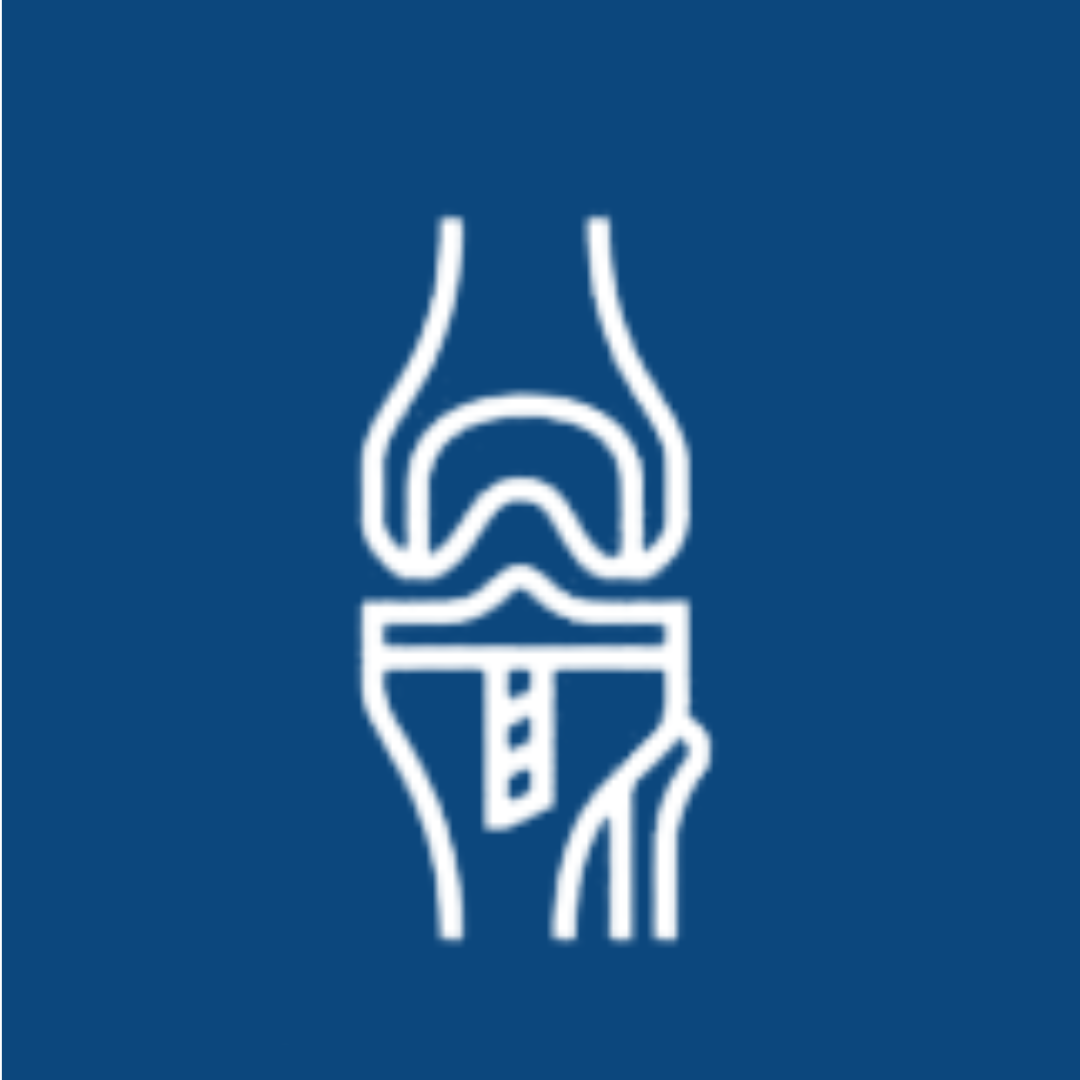 Knee Replacement
