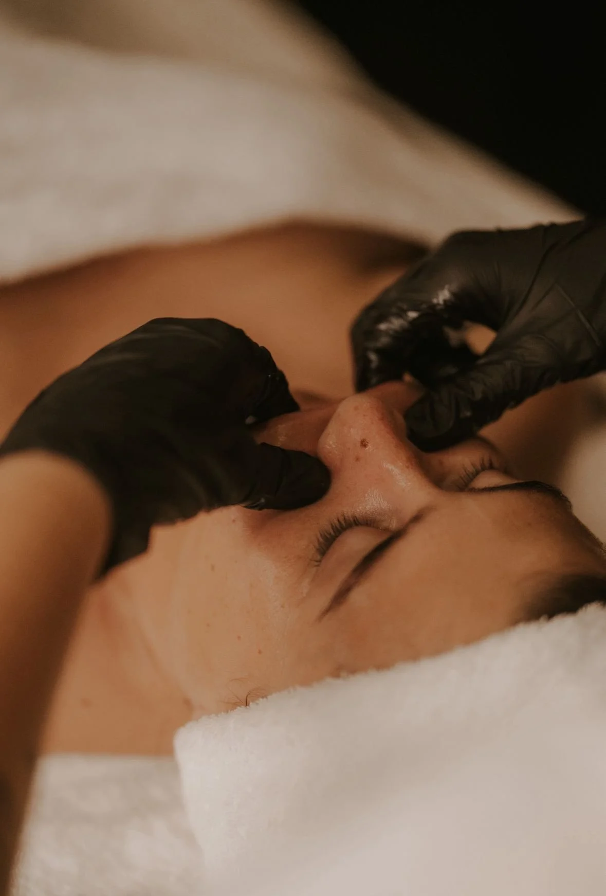 A person receiving a facial treatment, with a practitioner wearing black gloves gently working on their nose.