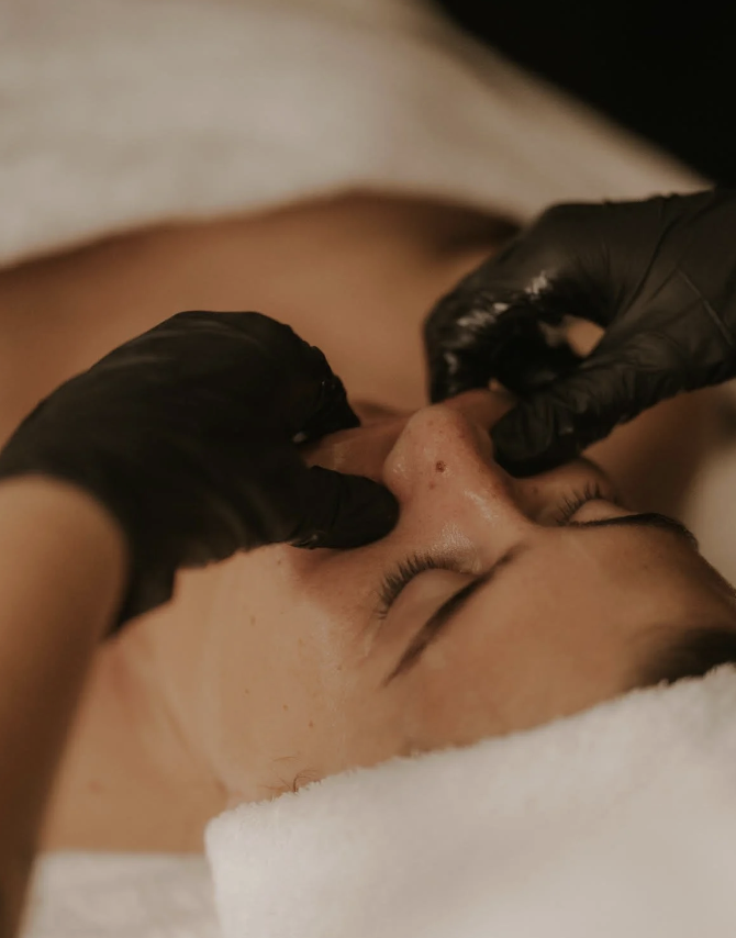 Intrabuccal Facelift y tratamiento del bruxismo