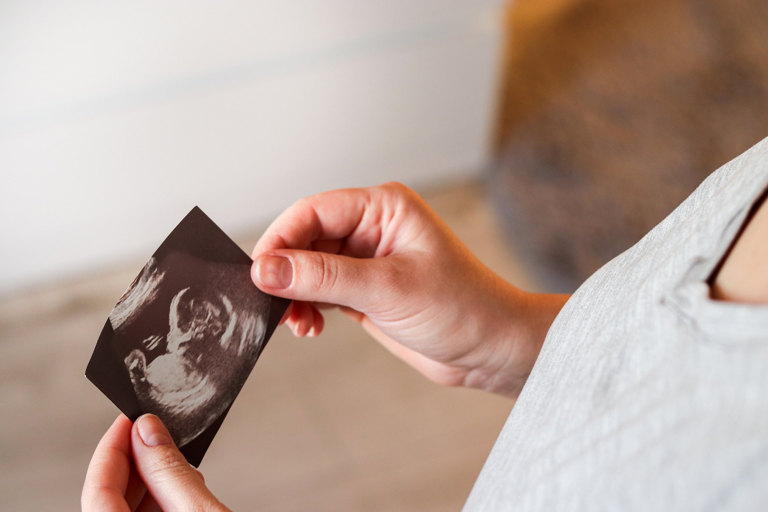Person holding an ultrasound image of a fetus.