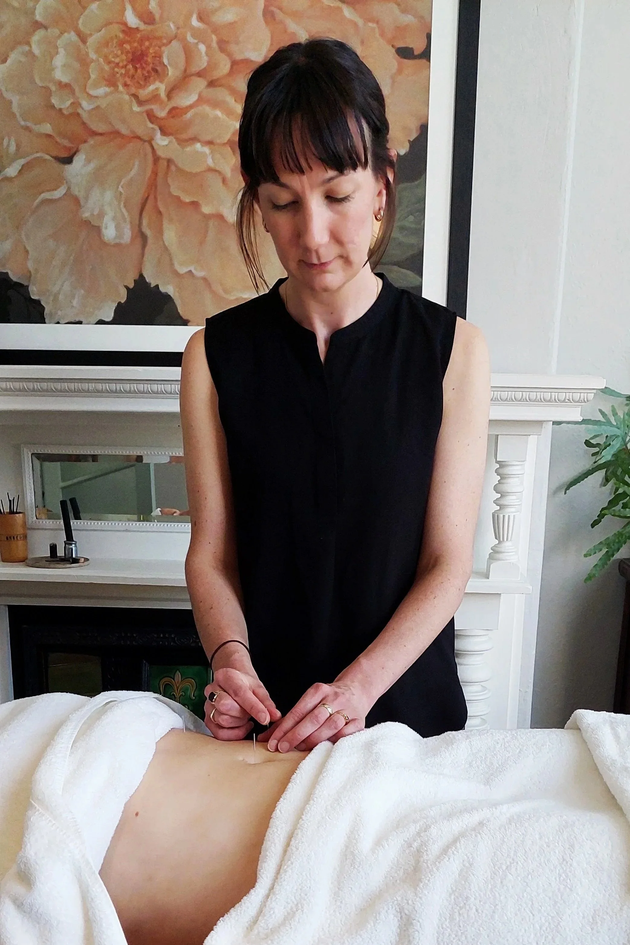 Practitioner placing acupuncture needles in the abdomen