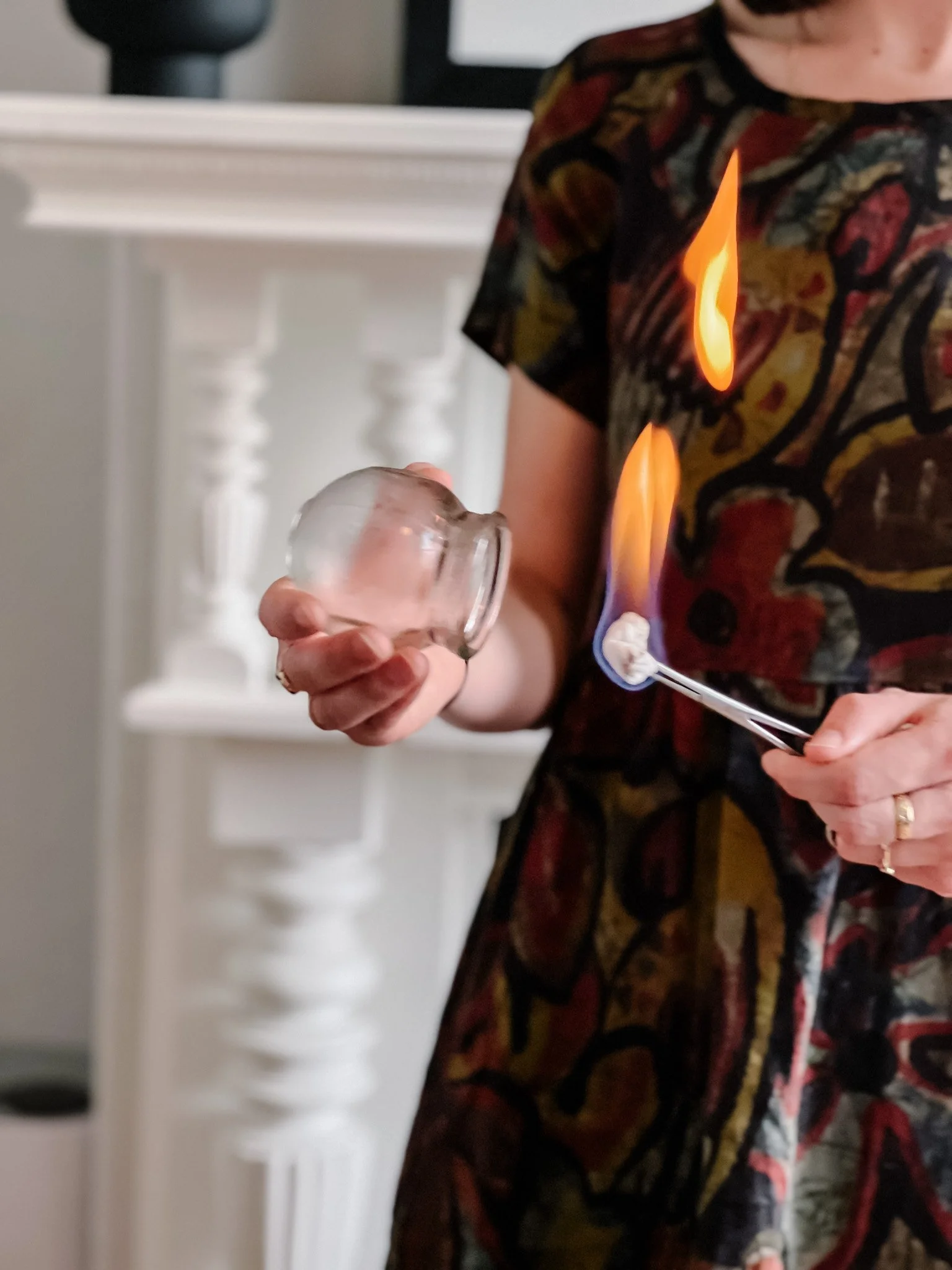 Practitioner using a flame to do cupping therapy