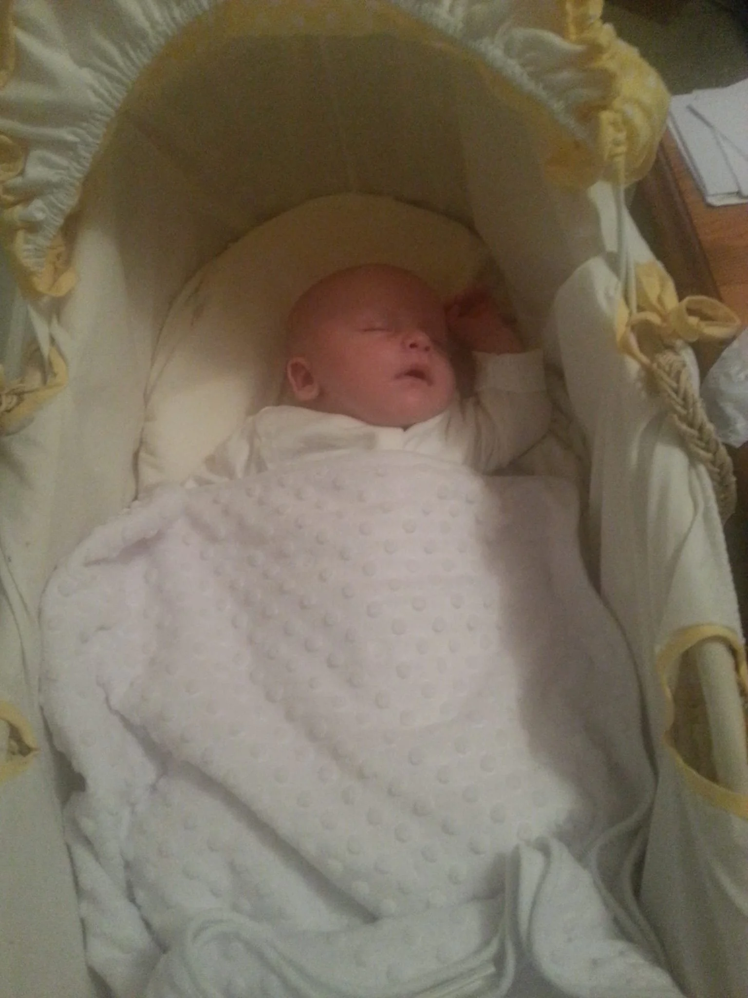 This was my son the evening after his healing for reflux