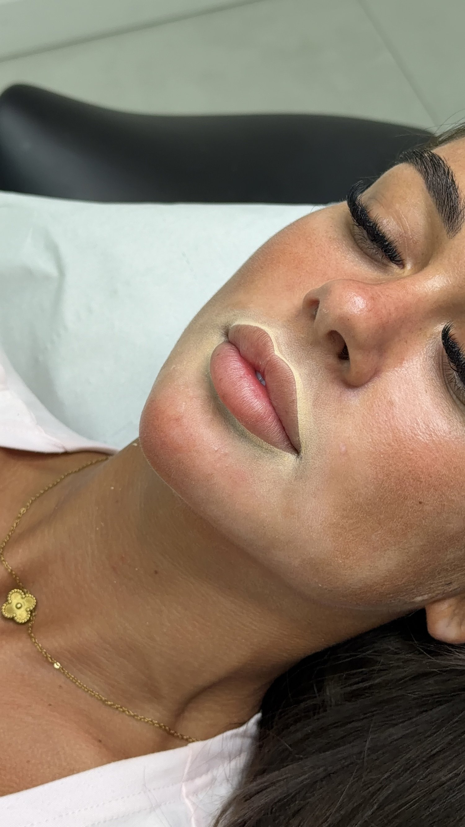 Healed lip blush