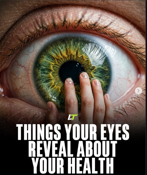 Eyes ARE the Windows to Your Health