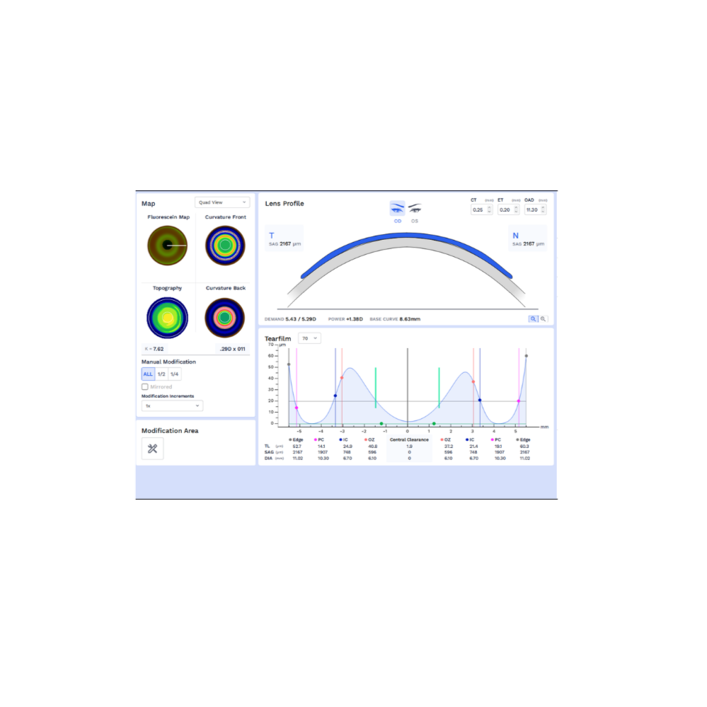 WAVE NightLens orthokeratology lenses. 
