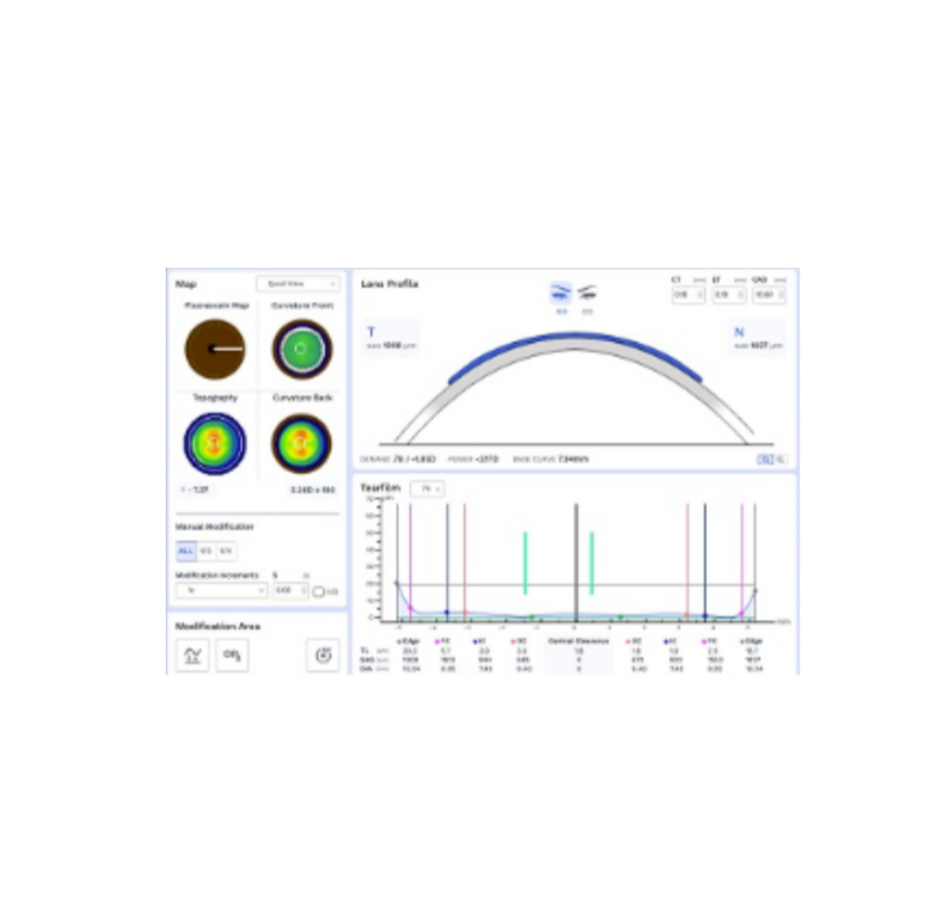 Wave CorneaLens. A scan-based, custom corneal gas permeable contact lens design.