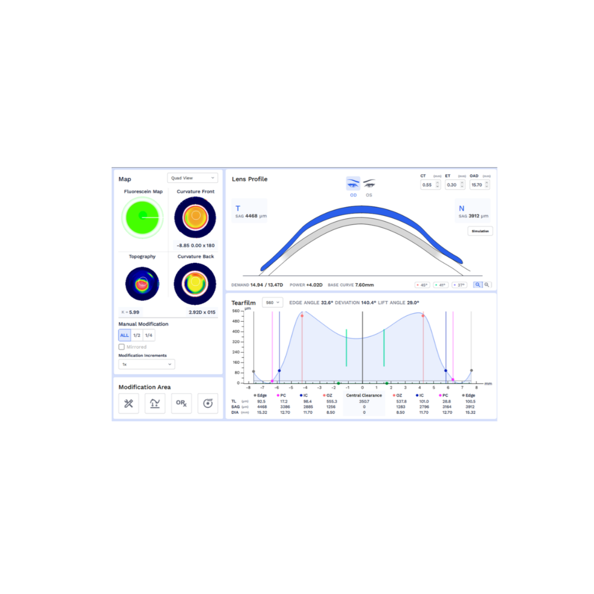 WaveScleral scan-based scleral lens fitting.