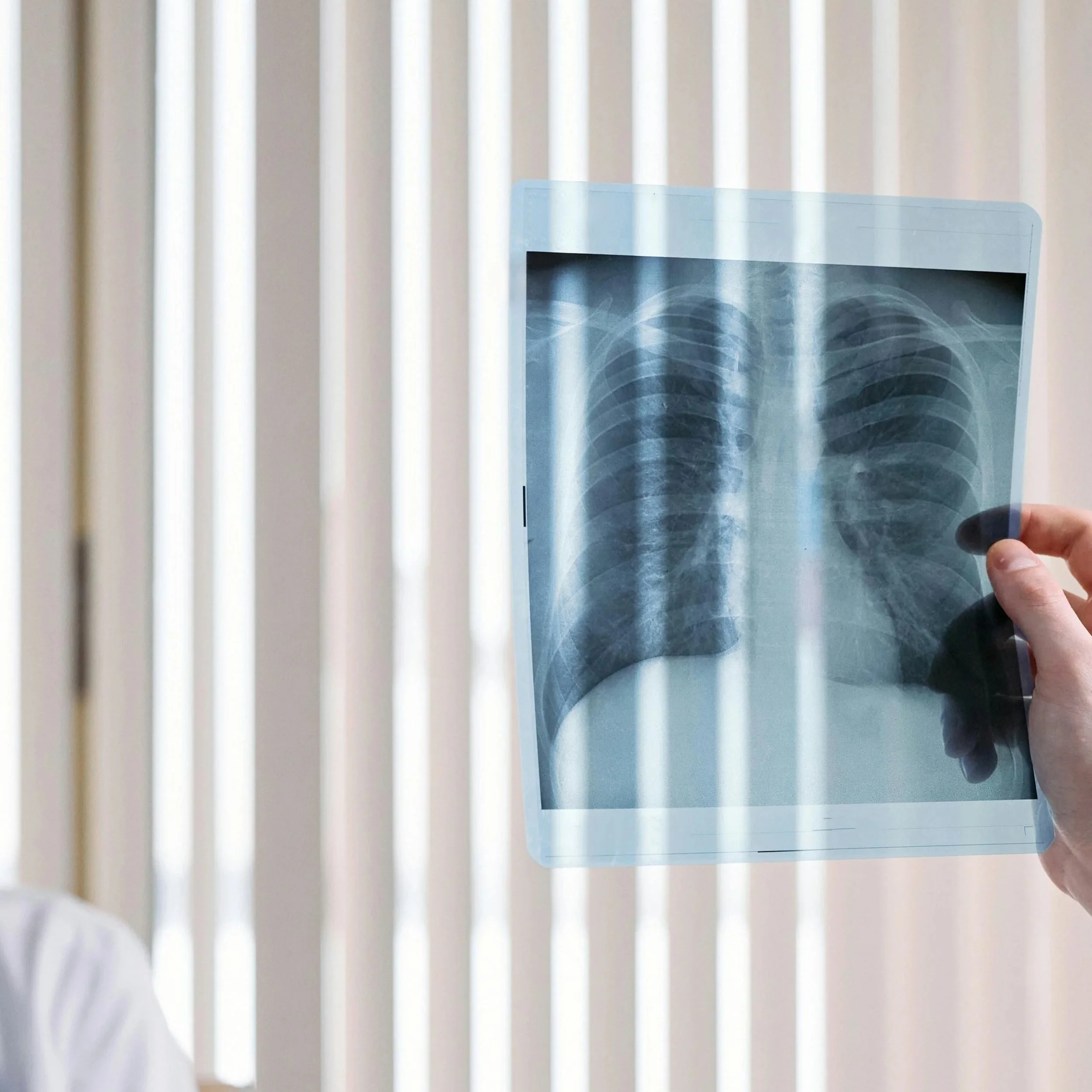 A healthcare professional holds an X-ray of a human chest showing ribs and lungs.