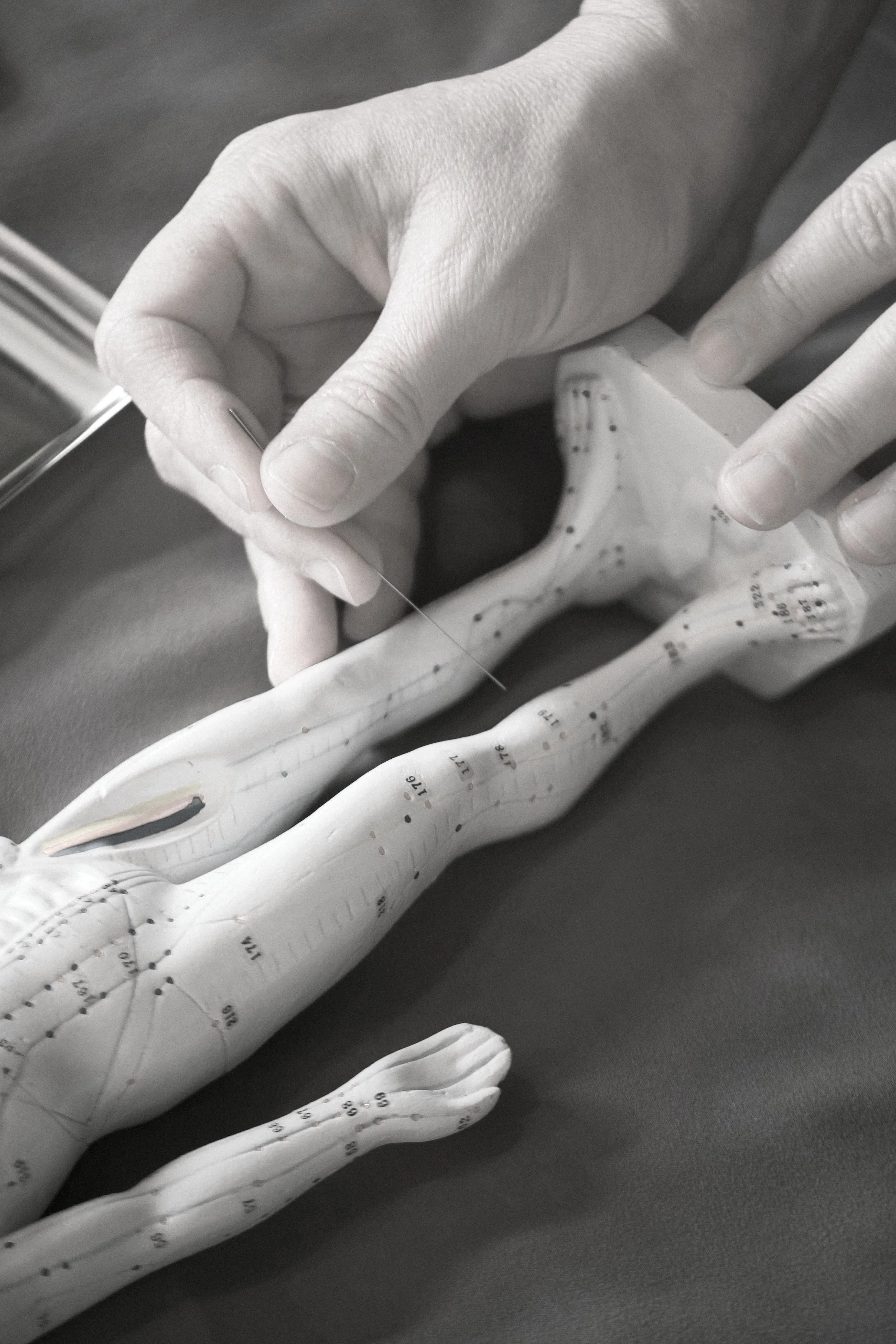 Acupuncture model — health and wellness industry compliance support