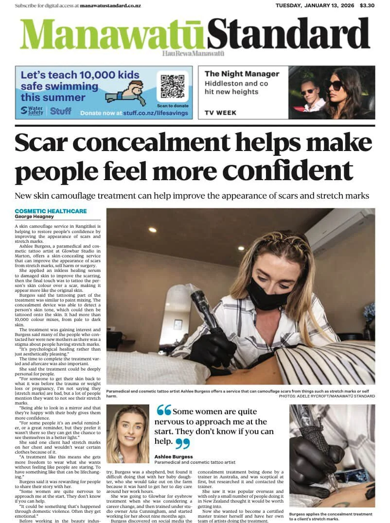 Ashlee from the manawatu featured in the manawatu standard discussing NUE Conceal skin camouflage for scars, stretchmarks and hair regeneration. Learn how Ashlee helps clients regain confidence