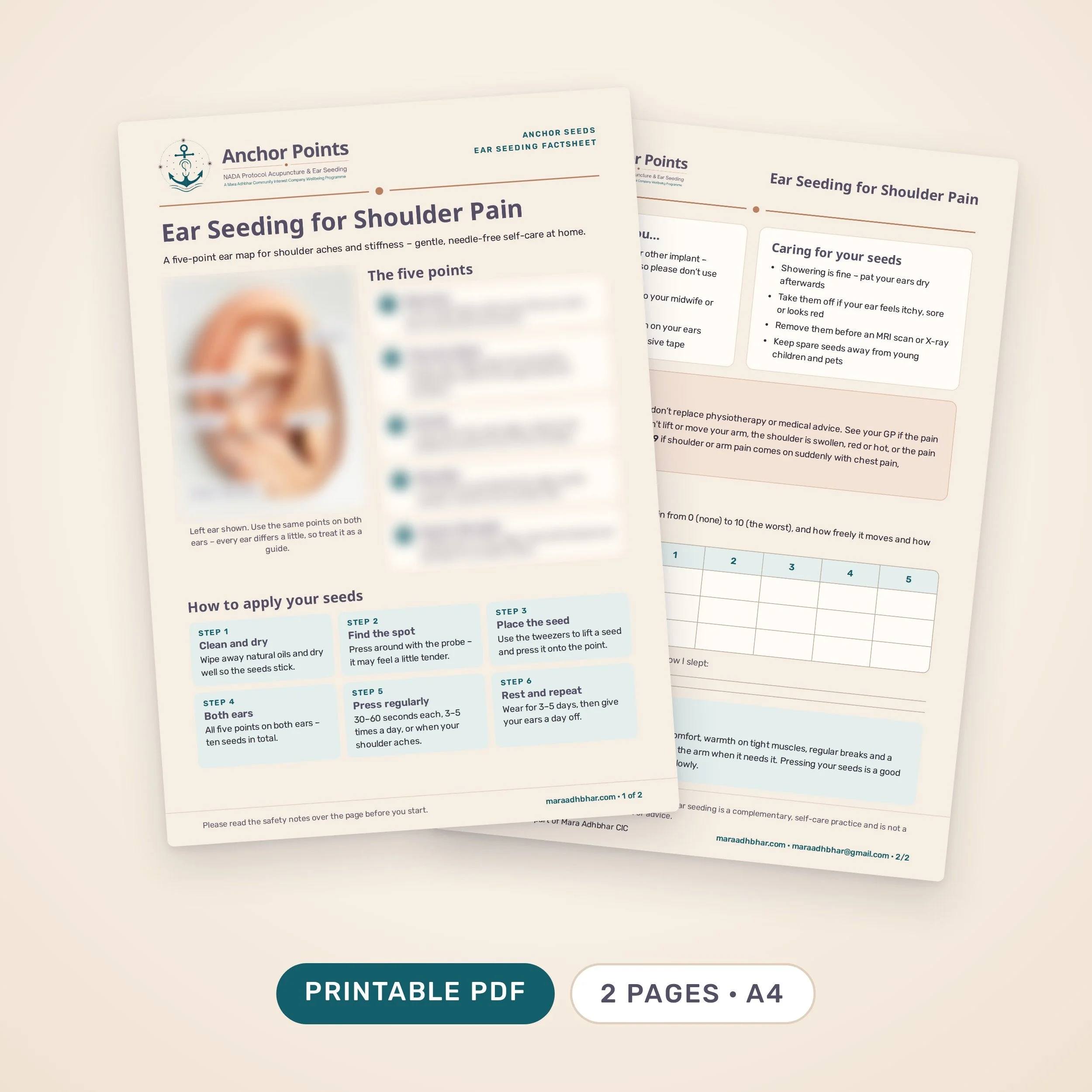 Anchor Points Ear Seeding For Shoulder Pain
