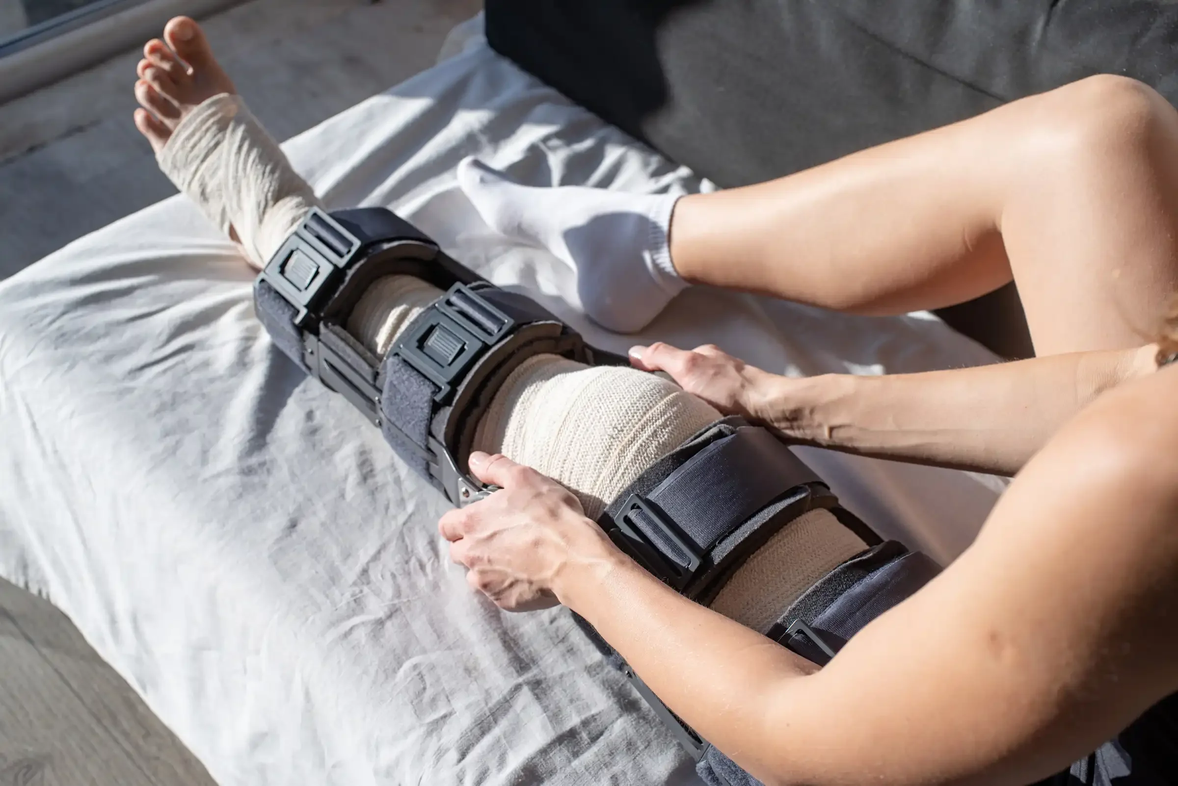 Two people exchanging a handshake, one wearing a medical ankle brace and the other with a bandaged arm, sitting on a bed.