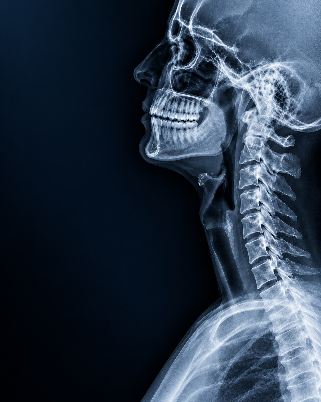 Side-view radiographic illustration of the skull and cervical spine.