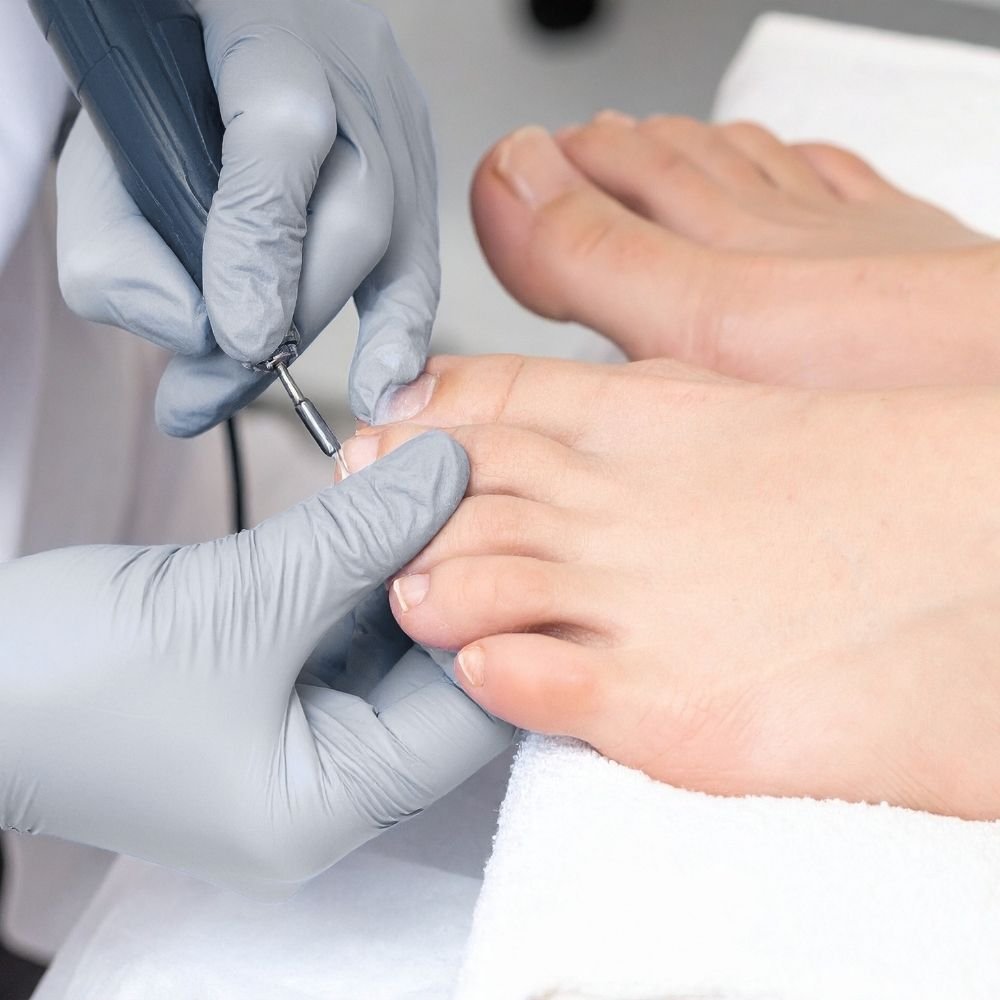 Gloved hands performing toenail care on a patient’s foot, representing routine and preventive podiatry care