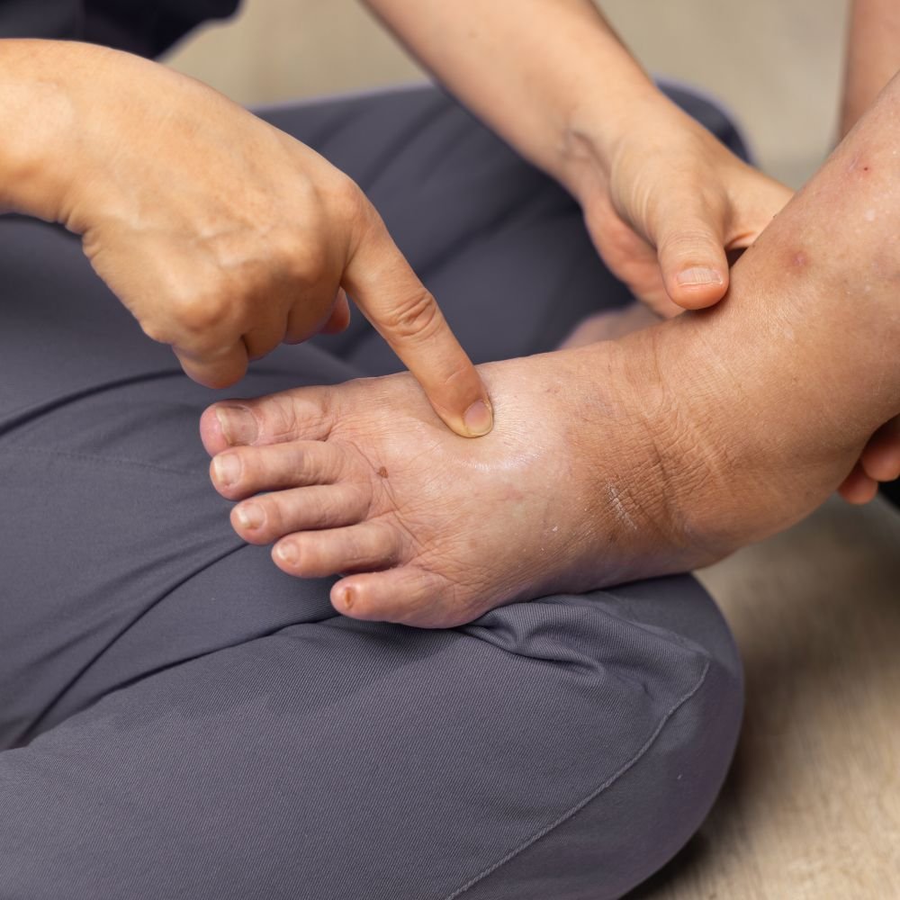 Diabetic Foot Problems