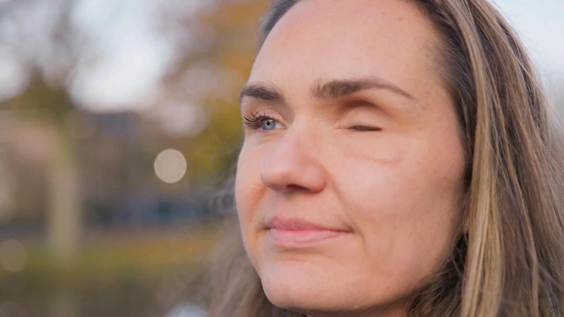 Bonita — Life After an Accident