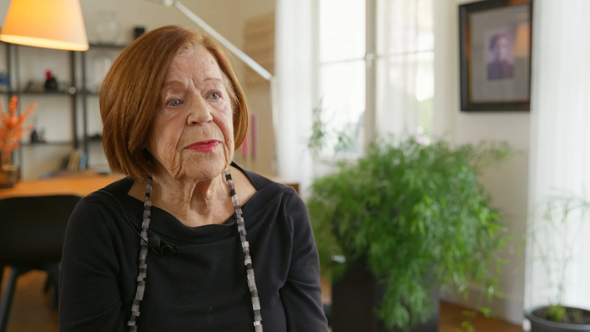 Henny — Living with an Eye Prosthesis