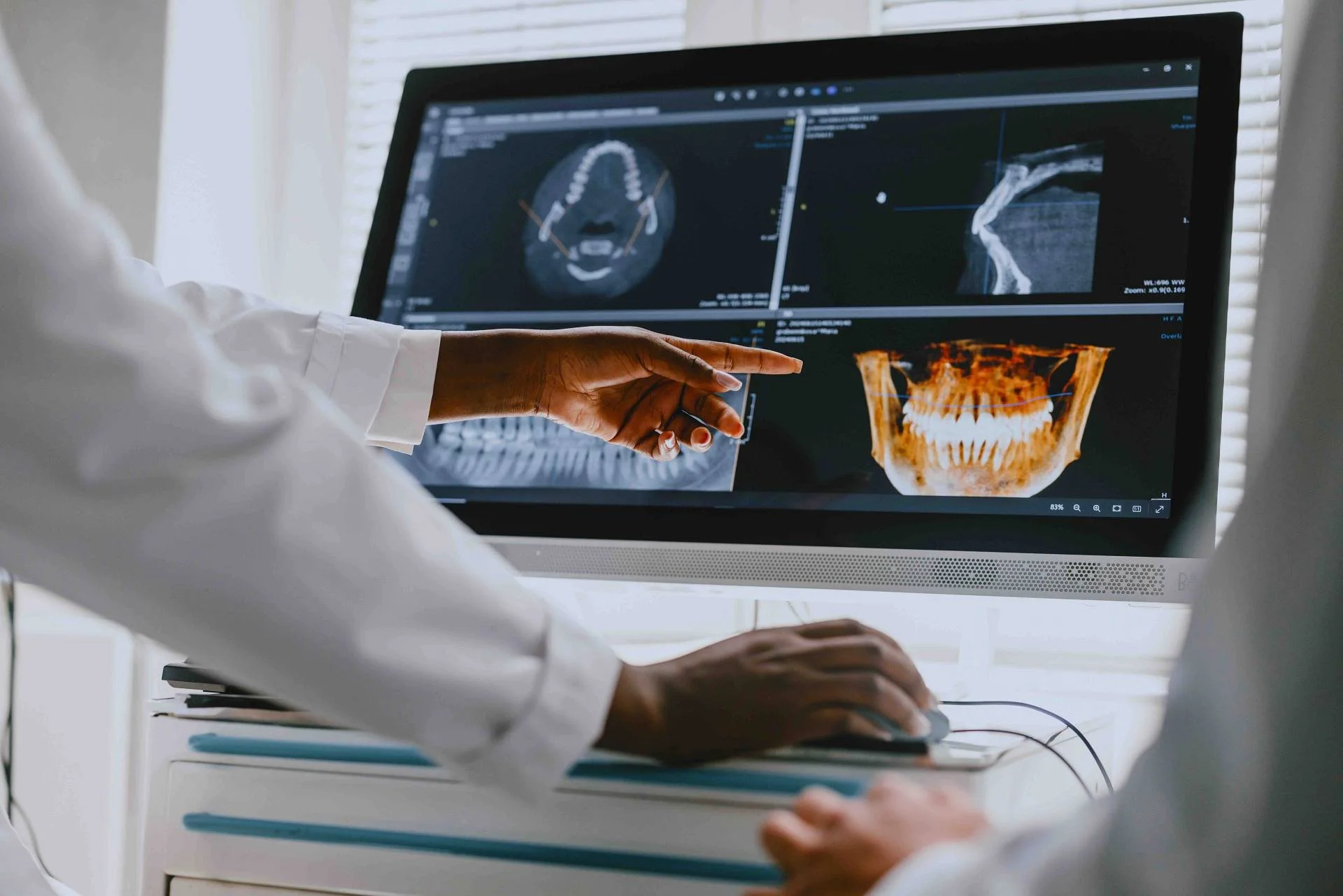 Dentist reviewing digital dental scan and CBCT imaging during treatment planning at a dental clinic in downtown Toronto