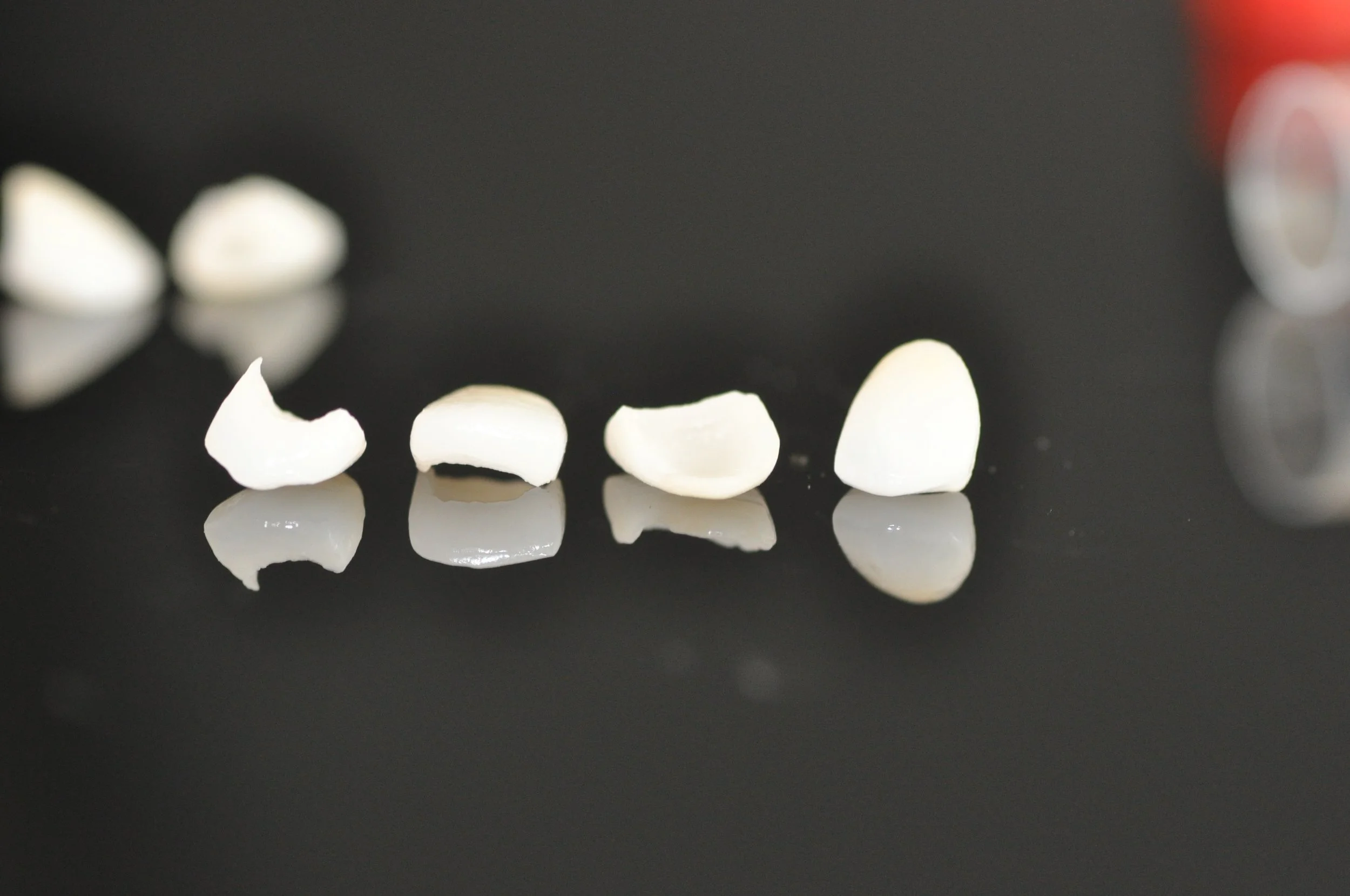 Porcelain laminate veneers used in cosmetic smile design at Innova Dental in Toronto.