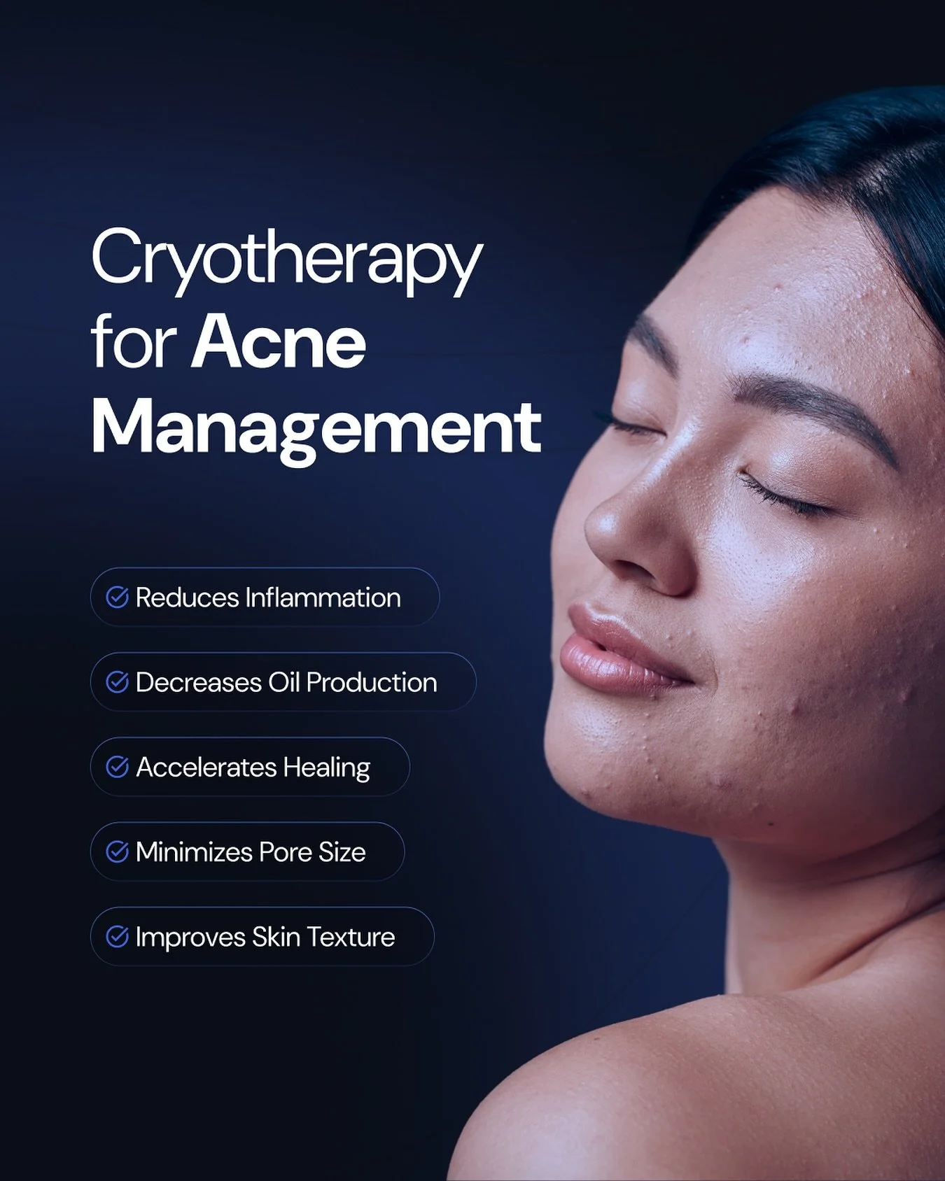Acne Management