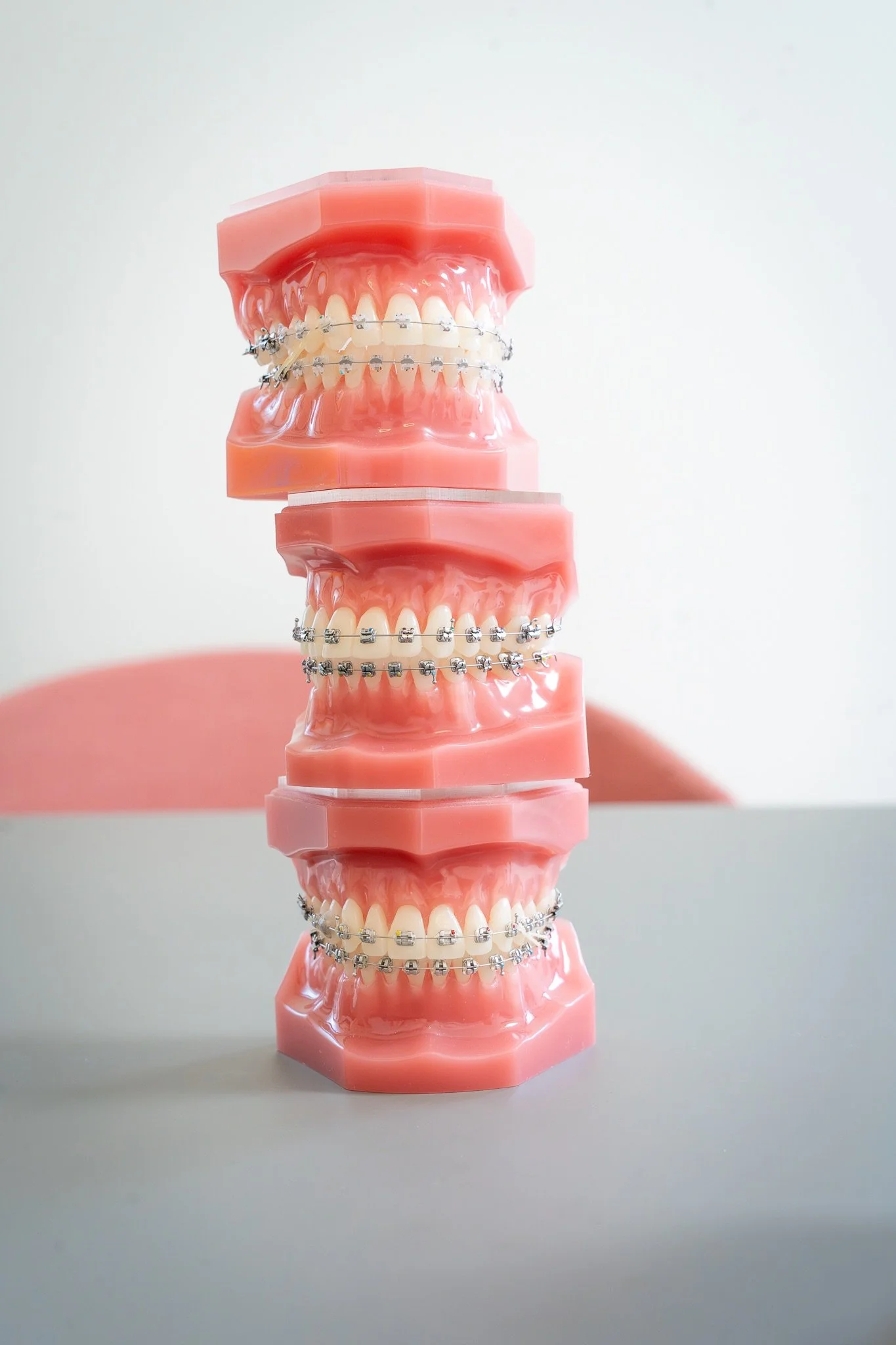 Modèle dentaire avec appareil orthodontique en métal sur des dents en plastique rose.