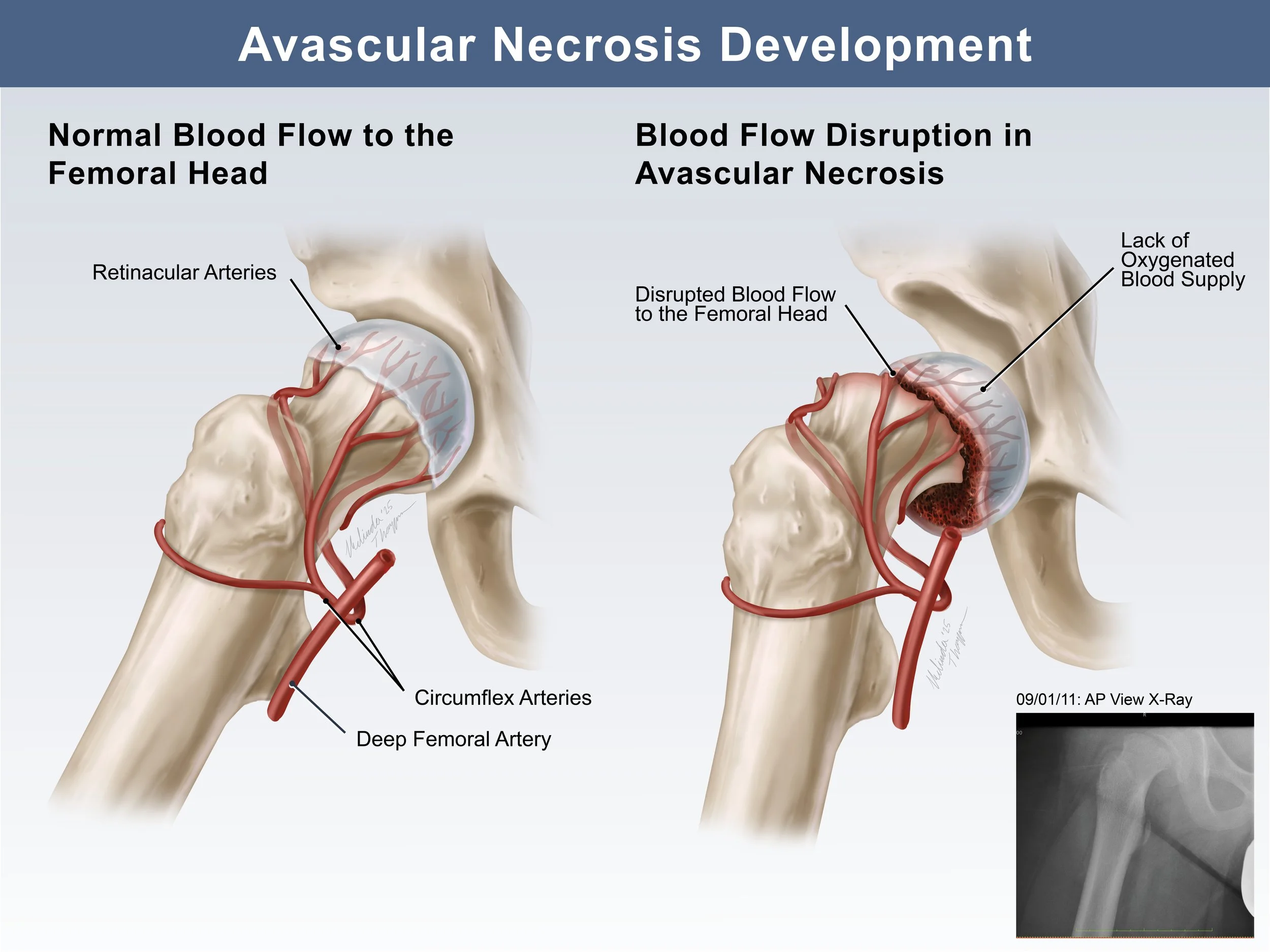 ThompsonM_BVIS538_SU25_A5_InDesign6 copy.jpg