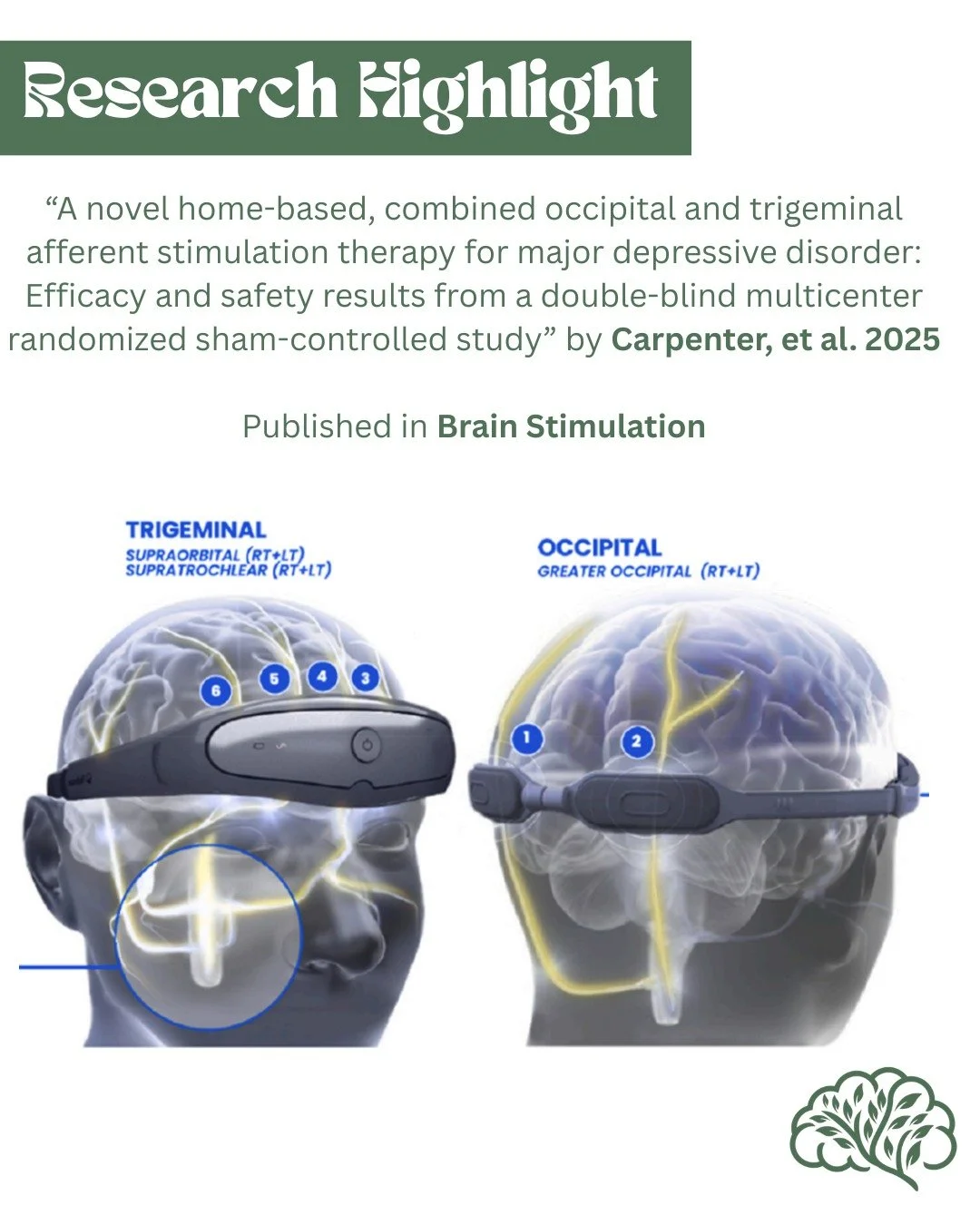 In this paper by Carpenter et al, the authors assessed the safety and efficacy of a novel and non-invasive brain stimulation therapy that delivers external combined Occipital and Trigeminal Afferent Stimulation (eCOT-AS) as a treatment option for tho