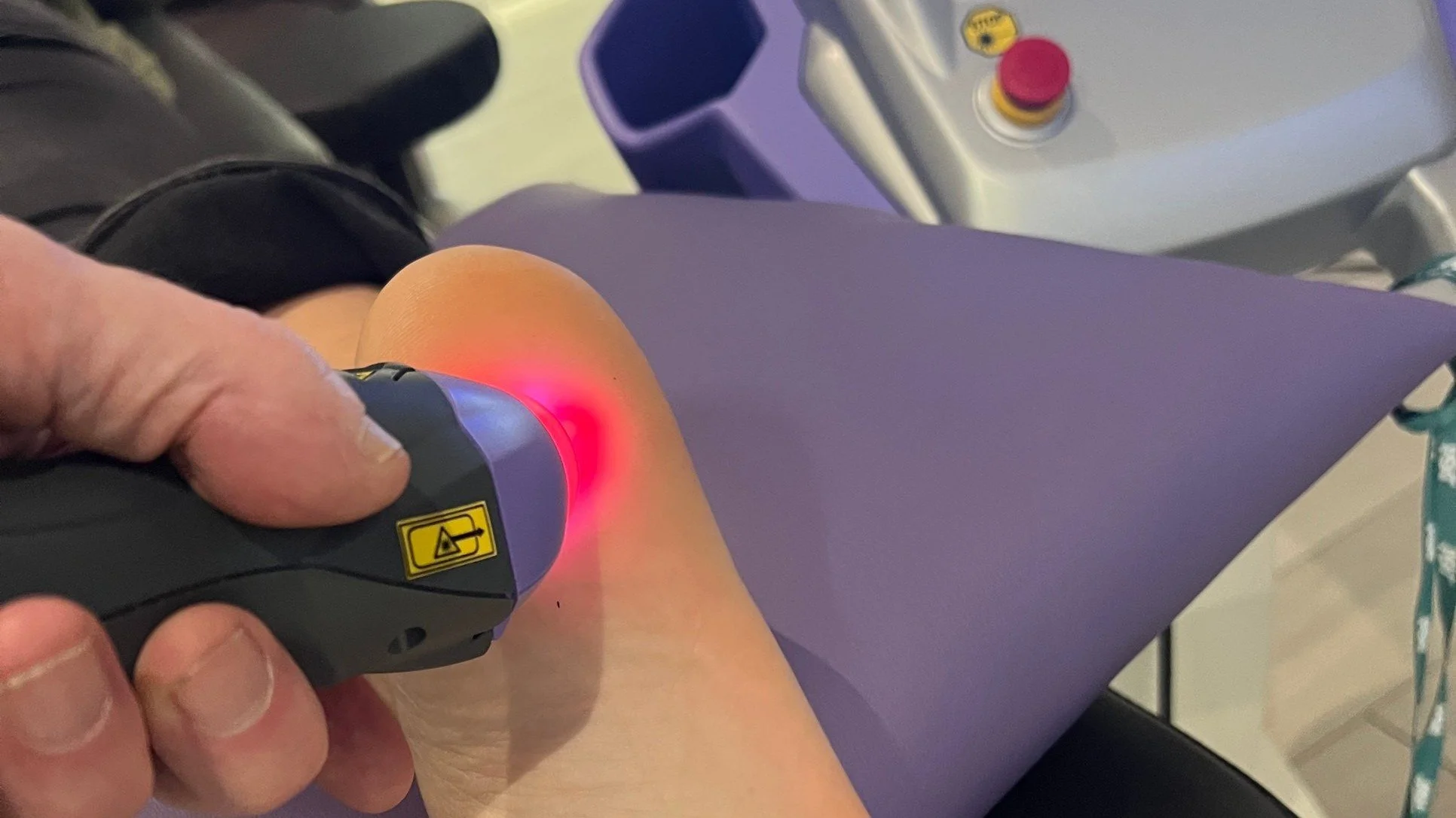 MLS laser therapy treating plantar fasciitis heel pain at Beyond Health and Wellness in Oak Forest, IL