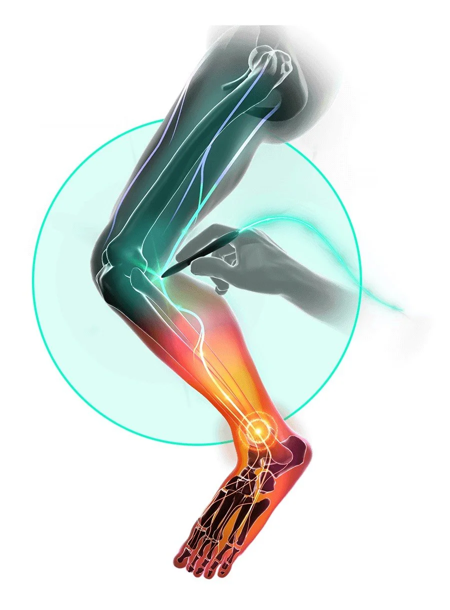 Stimpod neuropathy nerve pain treatment at Beyond Health and Wellness, Oak Forest IL