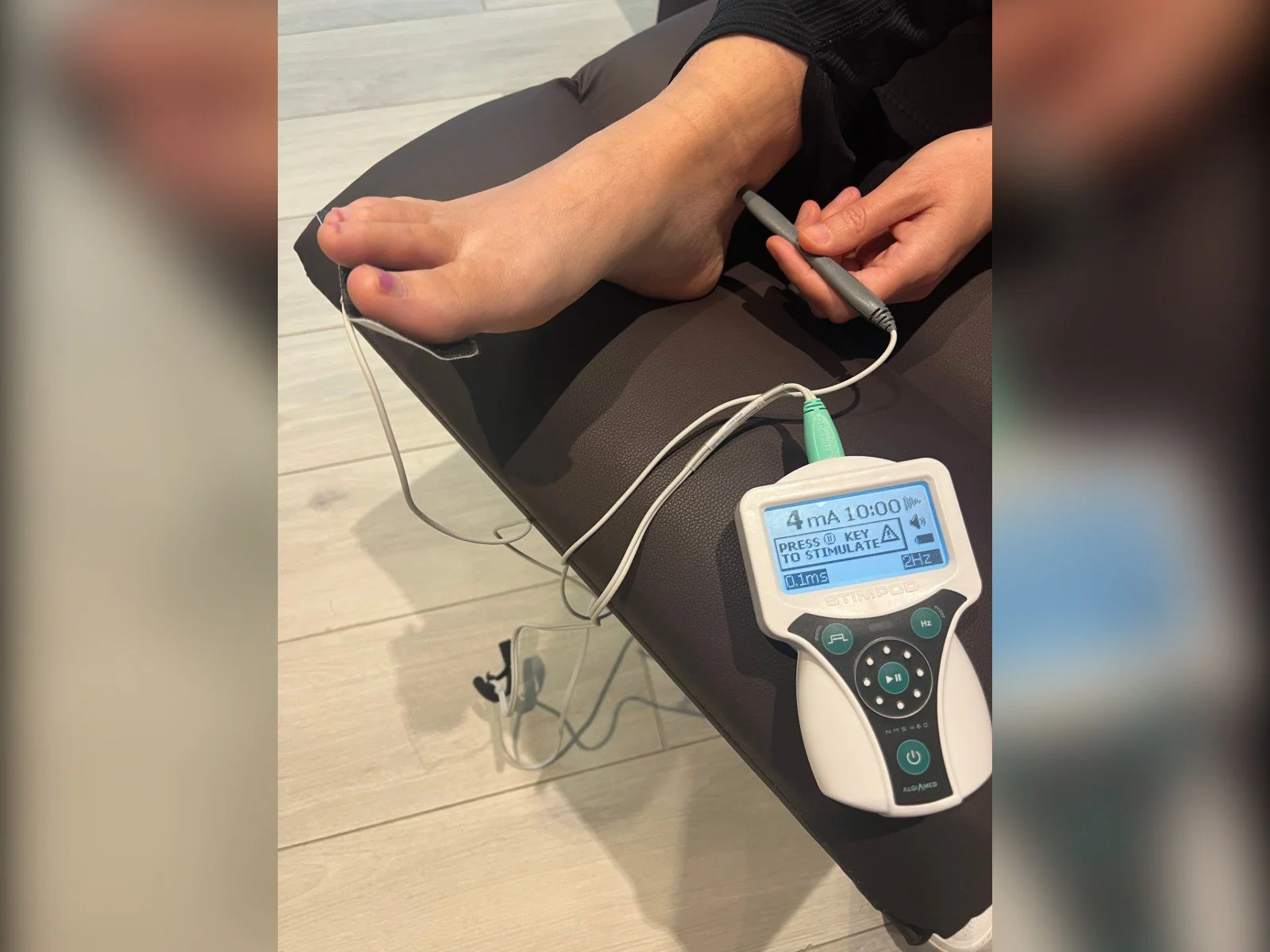 aStimpod neuropathy treatment on a patient's foot at Beyond Health and Wellness in Oak Forest, IL