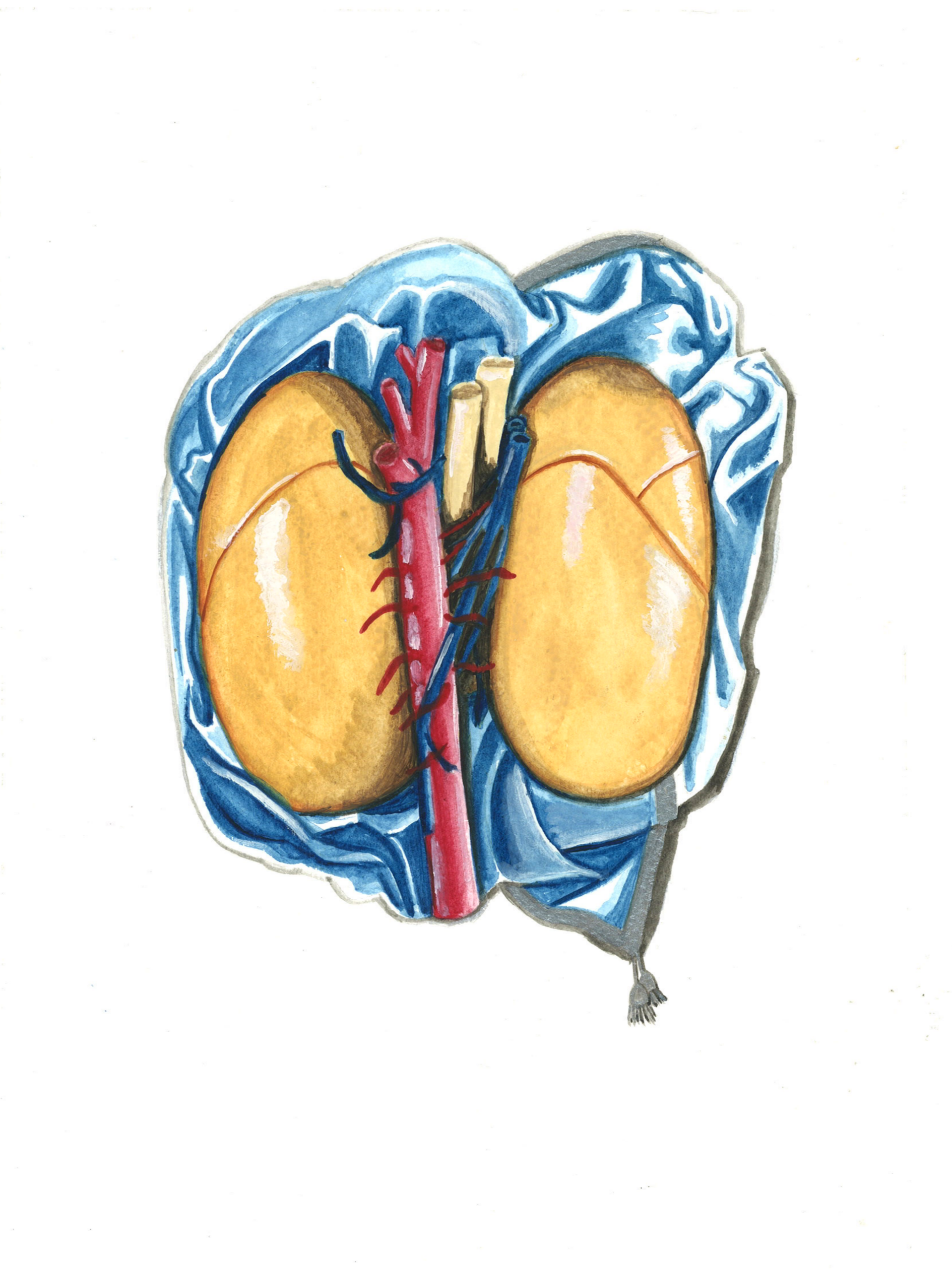 Illustration of a human brain with the temporal lobes exposed, showing blood vessels and internal structures.