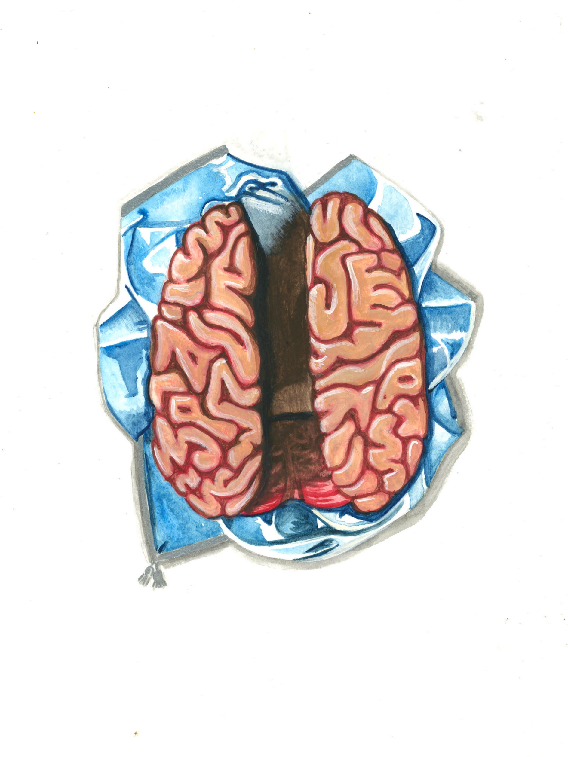 Colored illustration of a human brain with surgical cloth around it.