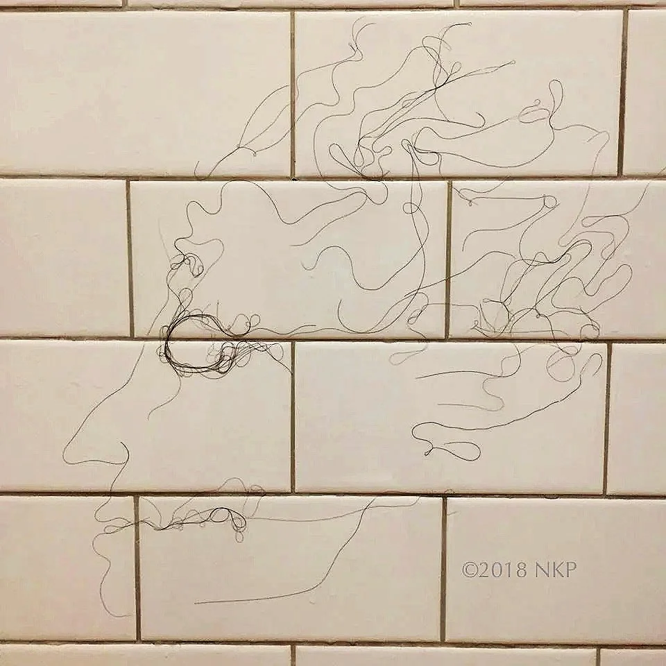 "Medusa"