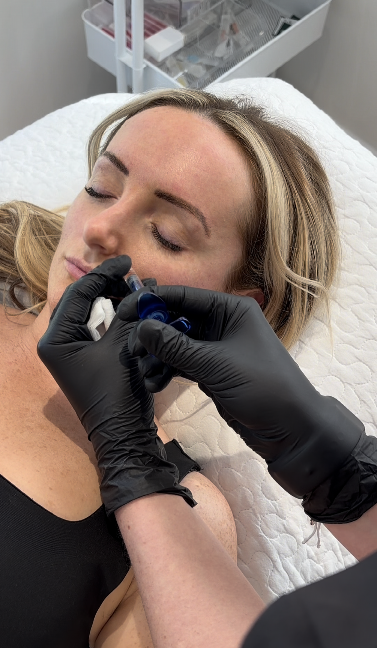 A woman receiving a cosmetic injection near her nose while lying on a treatment bed, with a medical professional wearing black gloves preparing the injection.