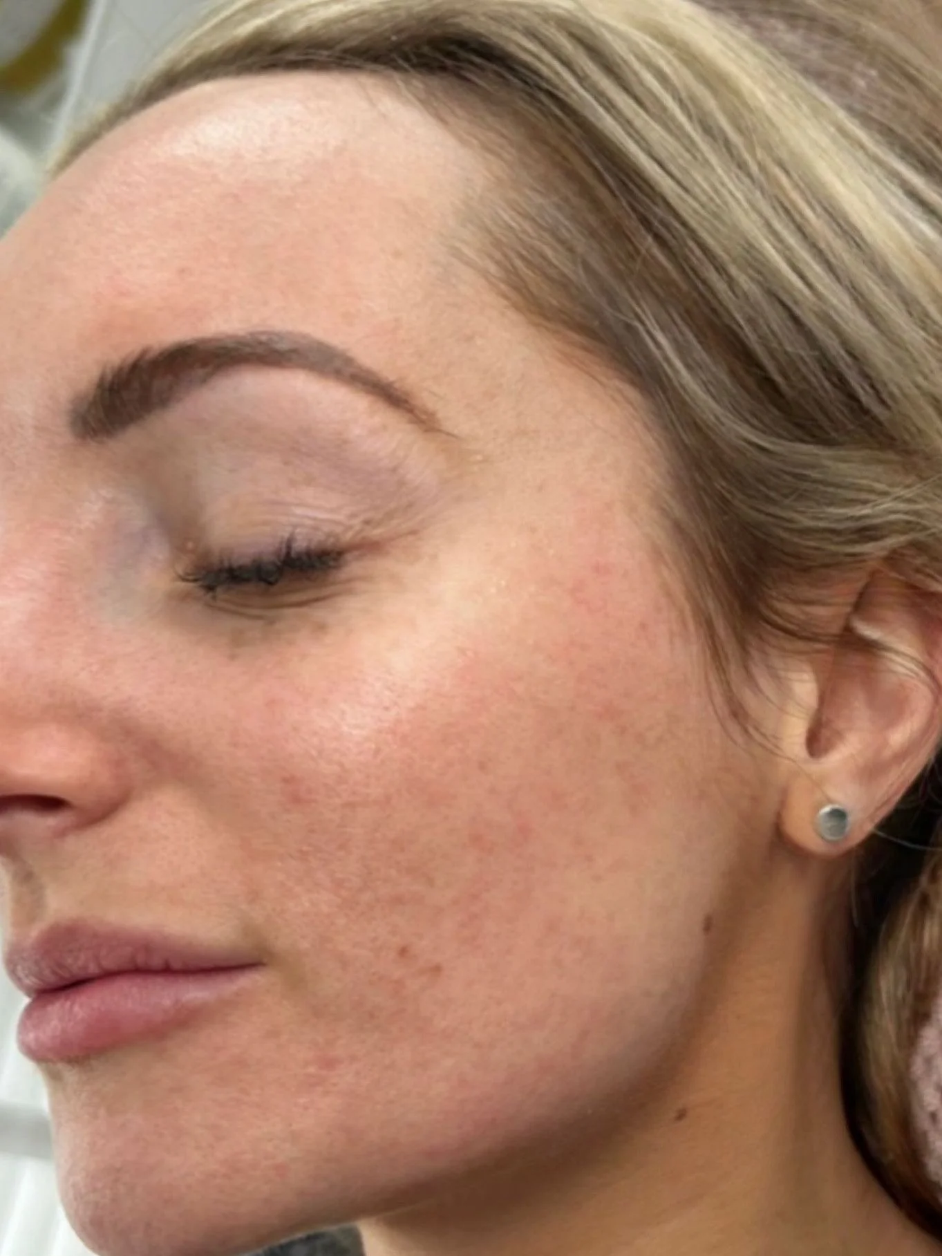 Close-up of a woman's face with visible freckles, blonde hair, and a small earring, with her eyes closed.