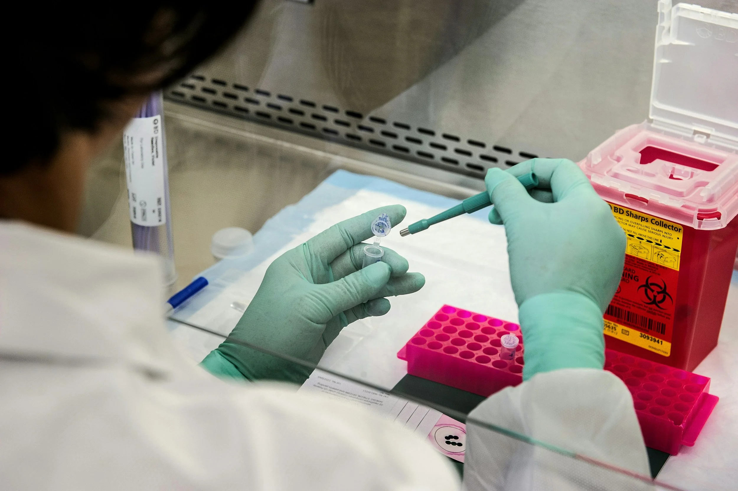 Laboratory technician wearing gloves handling a medical sample in a lab setting.