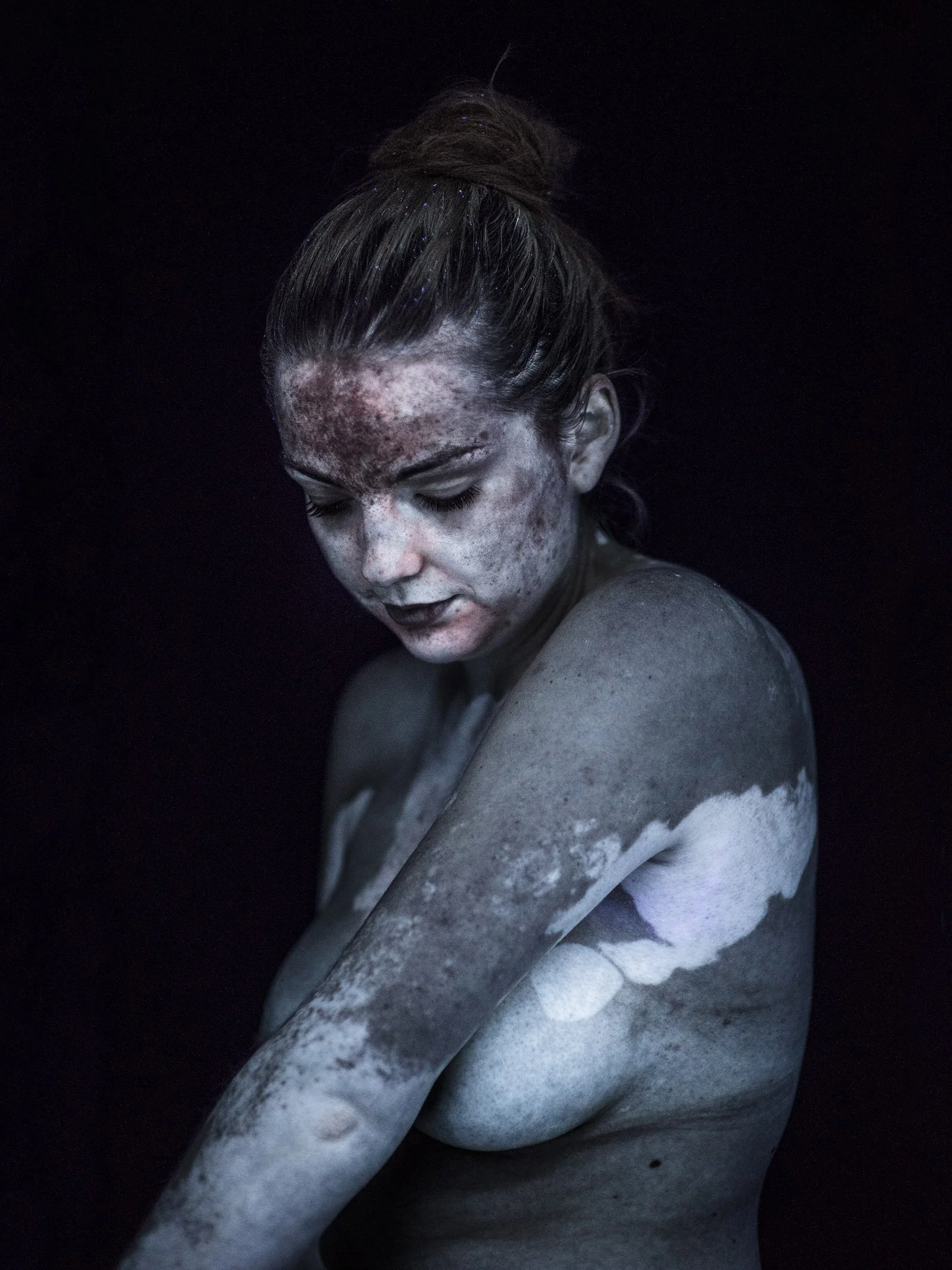 Cutis
  © Simon von Gunten