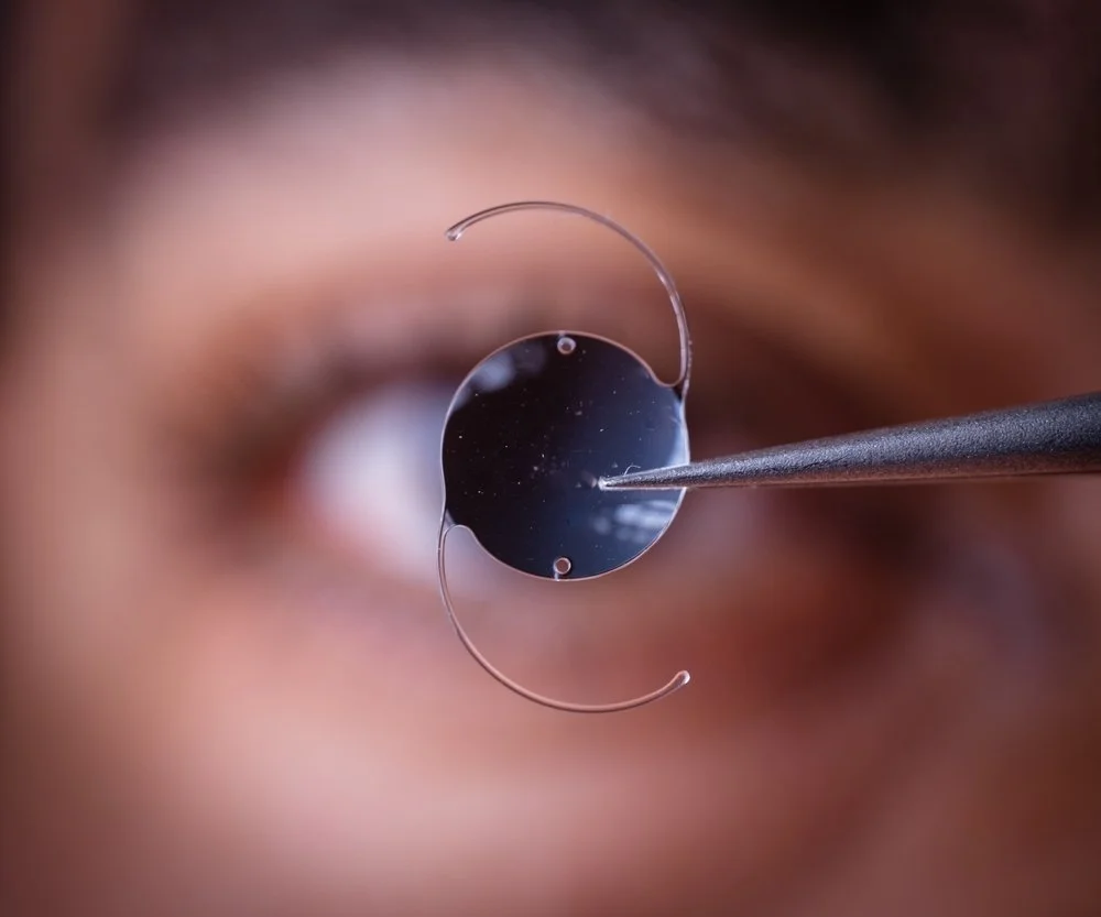 Close-up of a person's eye with an intraocular lens being inserted during cataract surgery.