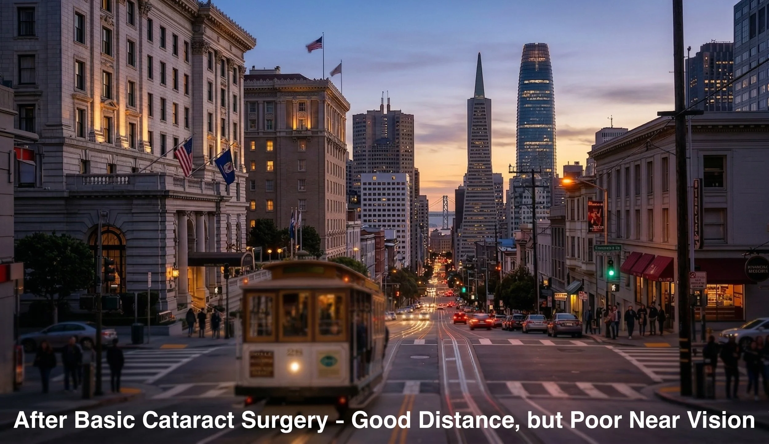 After basic cataract surgery, your vision will significantly improve, but you will still likely need to use prescription glasses in order to see everything clearly from far to near. 