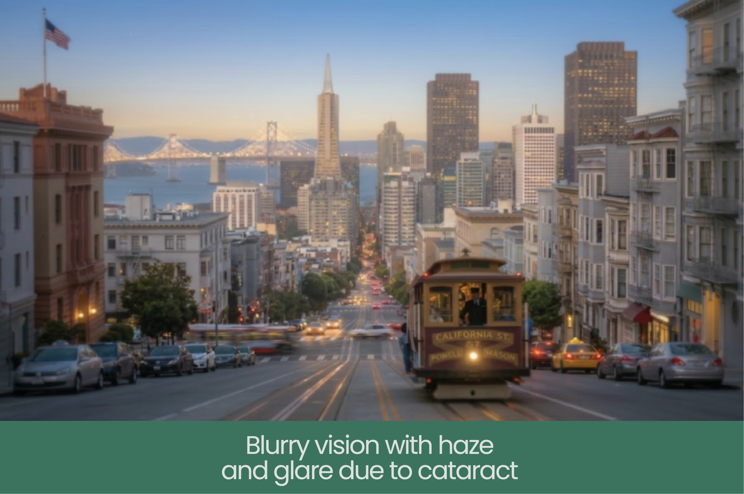 City street view with blurry buildings and trolley, hazy skyline, bay, and bridge in the background, with a banner text stating "Blurry vision with haze and glare due to cataract."