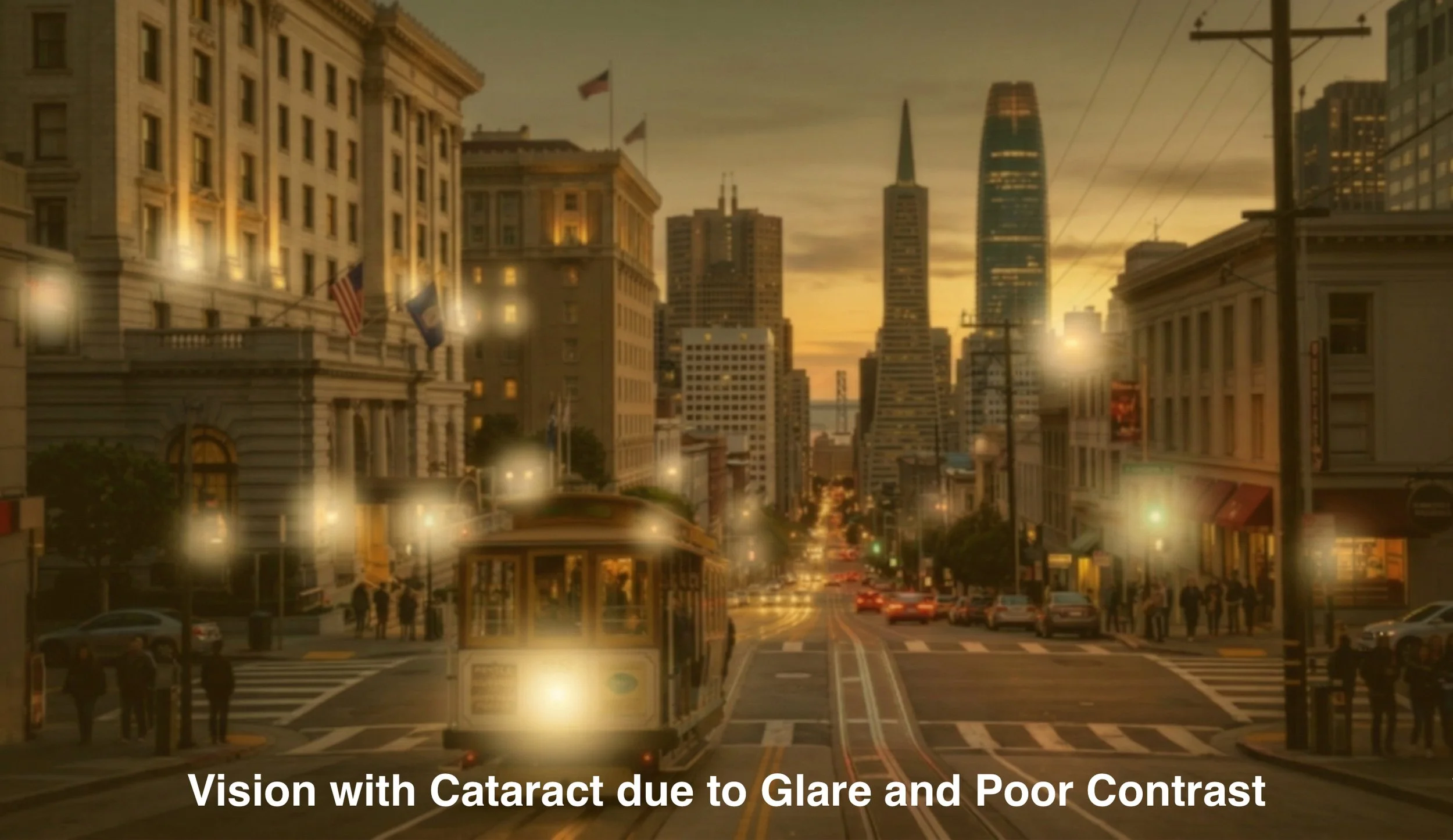 Vision through a cataract - notice the fuzzy tint along with glare and halo around the light sources. Patients often describe their vision as seeing through a dirty shower glass and do not want to drive at night due to the visual impairment.